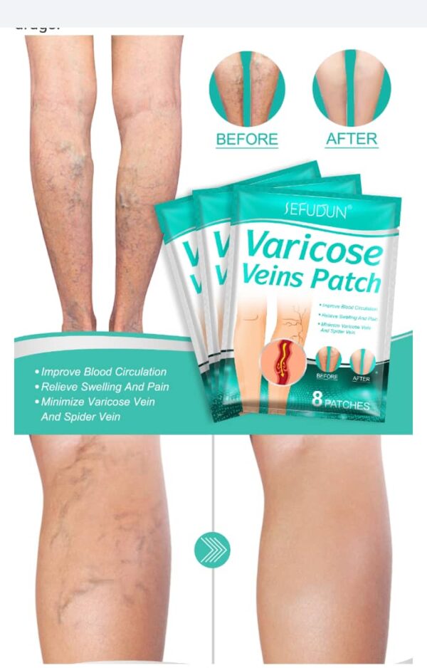 Varicose Veins Patch - Image 8