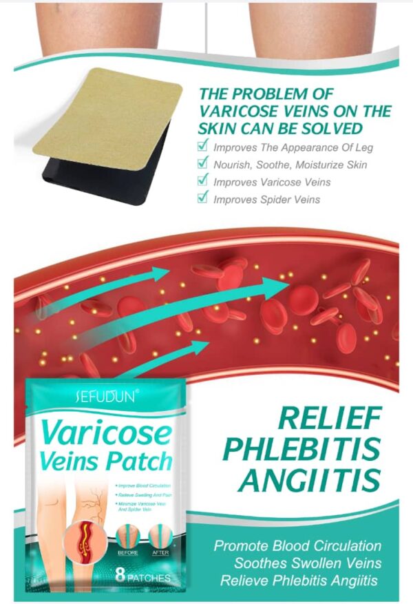 Varicose Veins Patch